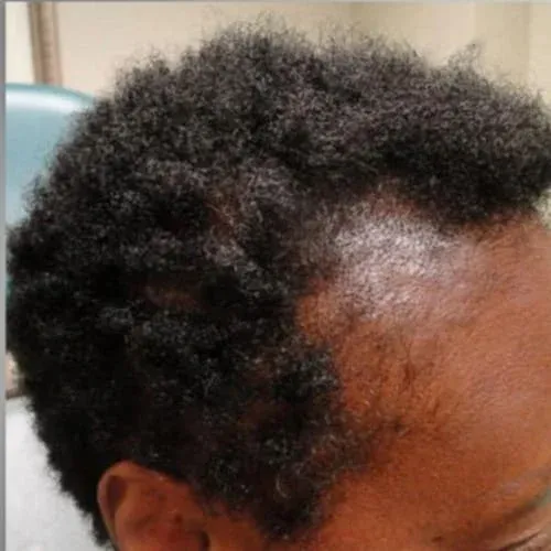 Close-up of textured natural hair.