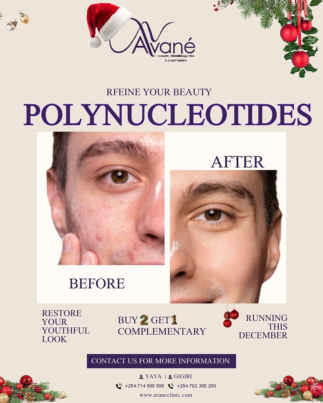 Before and after skincare treatment advertisement.