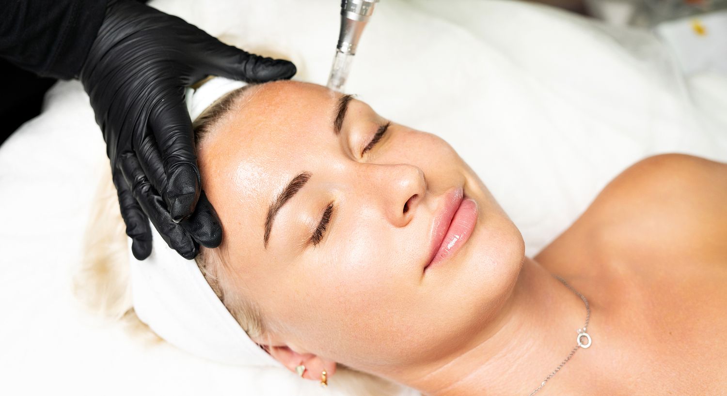 Microdermabrasion facial treatment in progress.